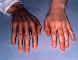 Latex sur Mains - Avant